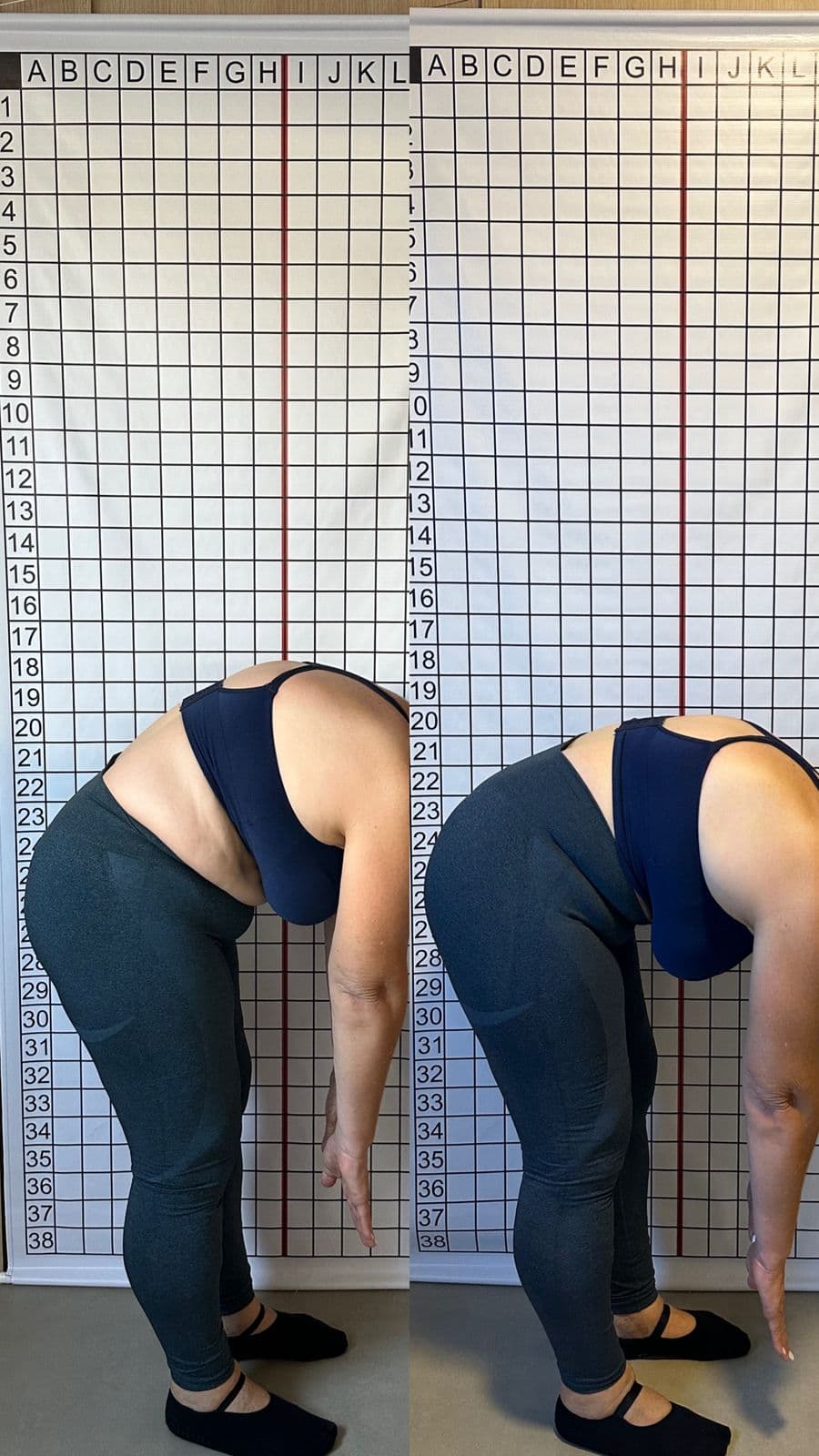 Resultado antes e depois — 1 mês